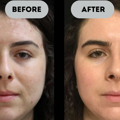 Monquess™ - Anti-Aging Booster Pro